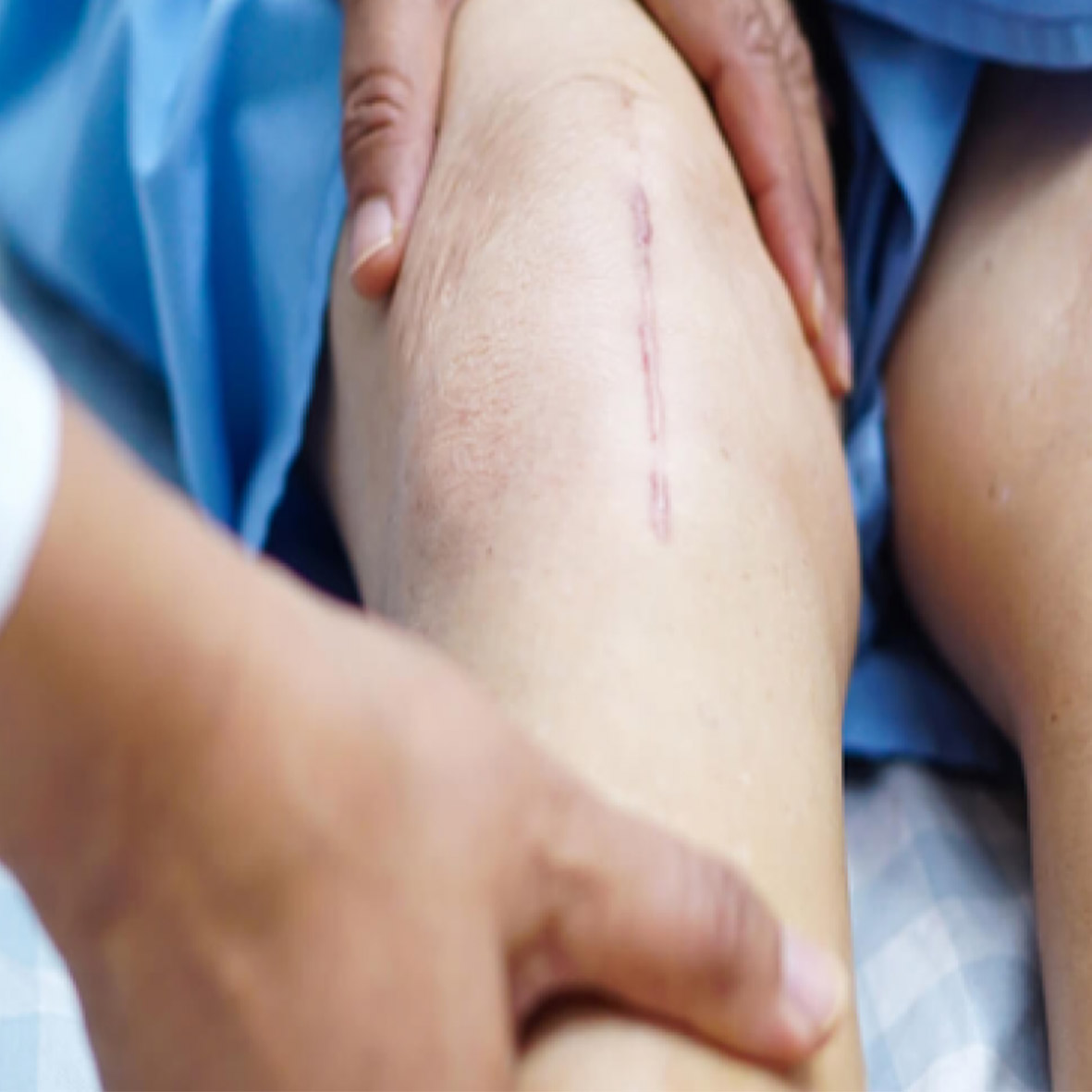 عوارض پس از جراحی ها