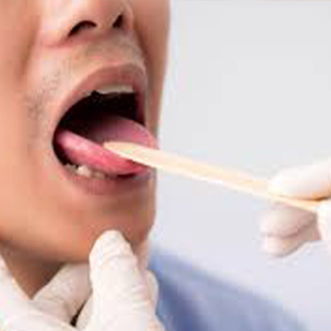 العلاج المتخصص لأمراض الفم